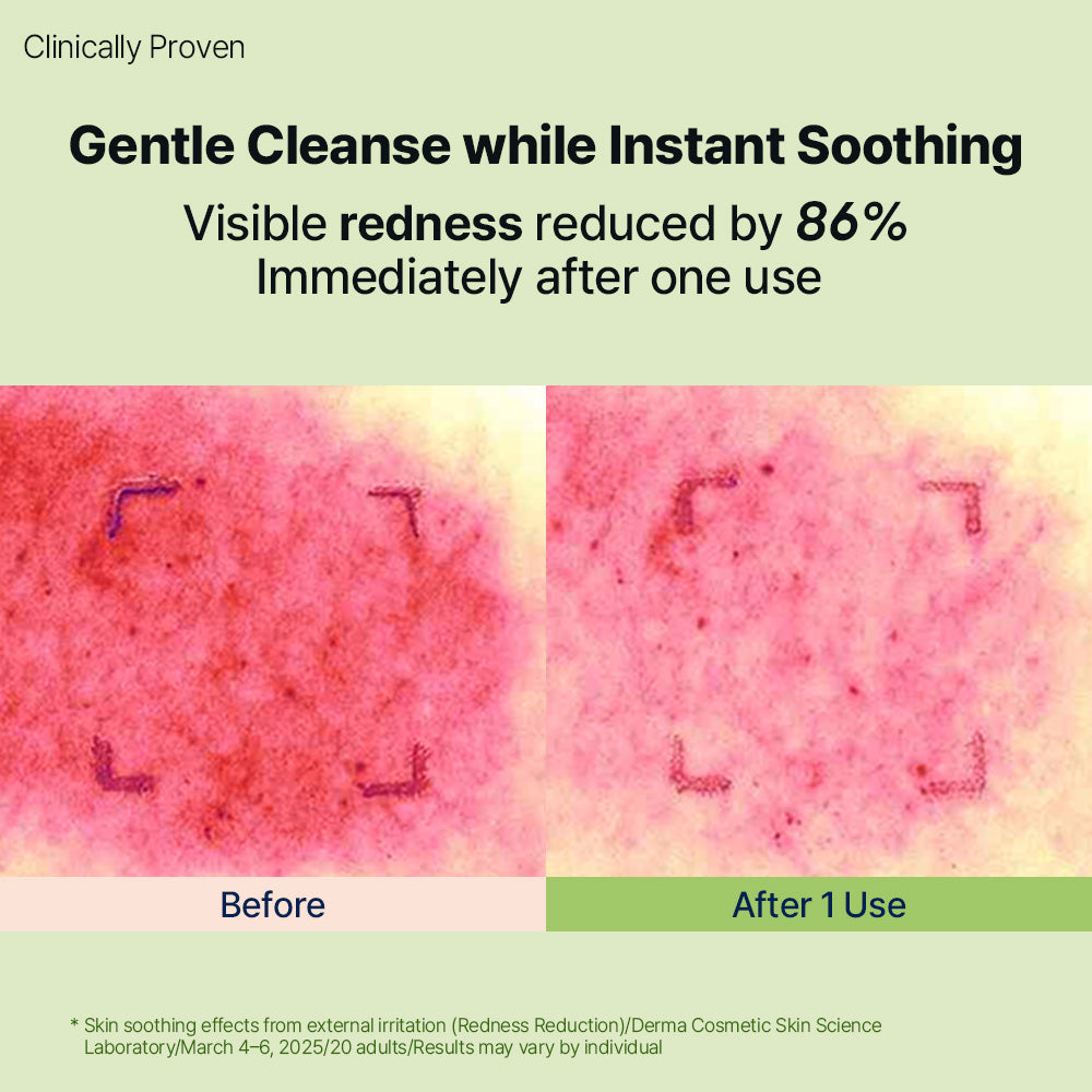 HYCICA Soothing Gentle Cleansing Foam 150ml